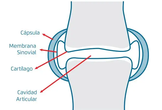 Depósito de cristales en articulaciones: Causas, síntomas y tratamiento - Cómo se cura Condrocalcinosis deposito de cristales en articulaciones - Cómo se cura Condrocalcinosis