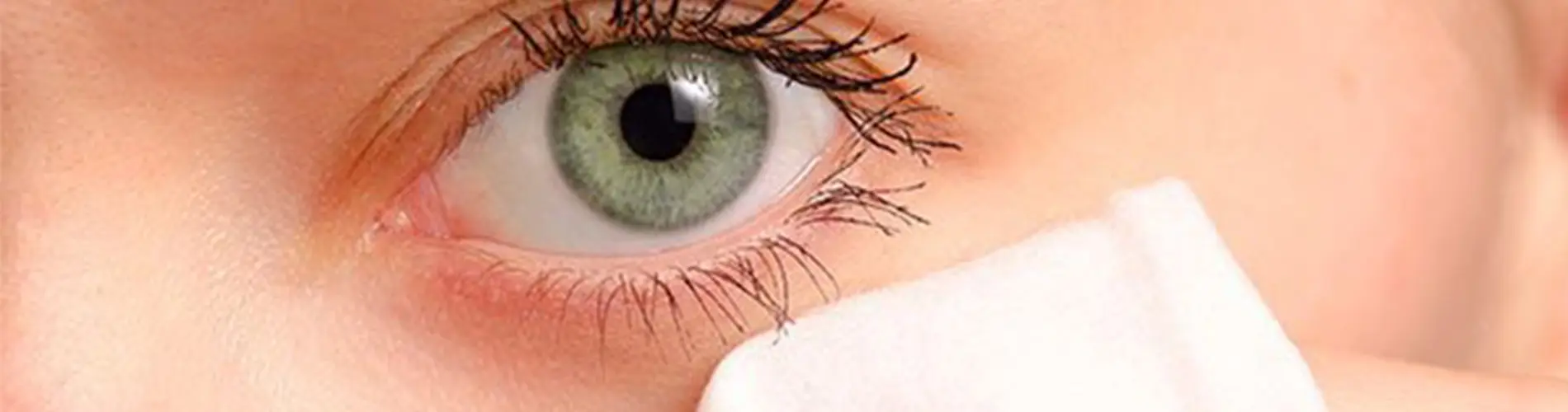vidrio en el ojo sintomas - Cómo se limpia el vidrio del ojo