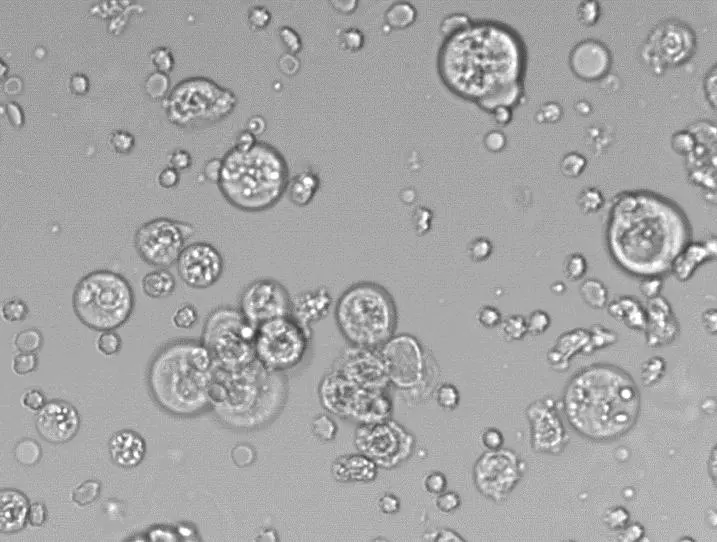 Cristales de glucosa en orina: ¿Qué son y qué significan? - Cómo se ve la glucosa en orina cristales de glucosa en orina - Cómo se ve la glucosa en orina