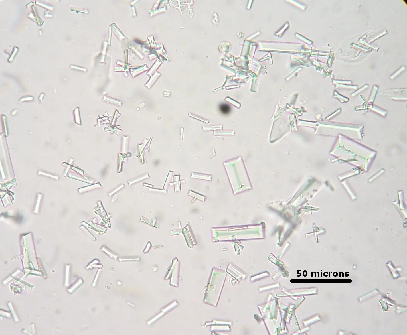 Cristales en la orina de los perros: Causas, síntomas y tratamientos - Cómo tratar urolitiasis en perros cristales orina perro - Cómo tratar urolitiasis en perros