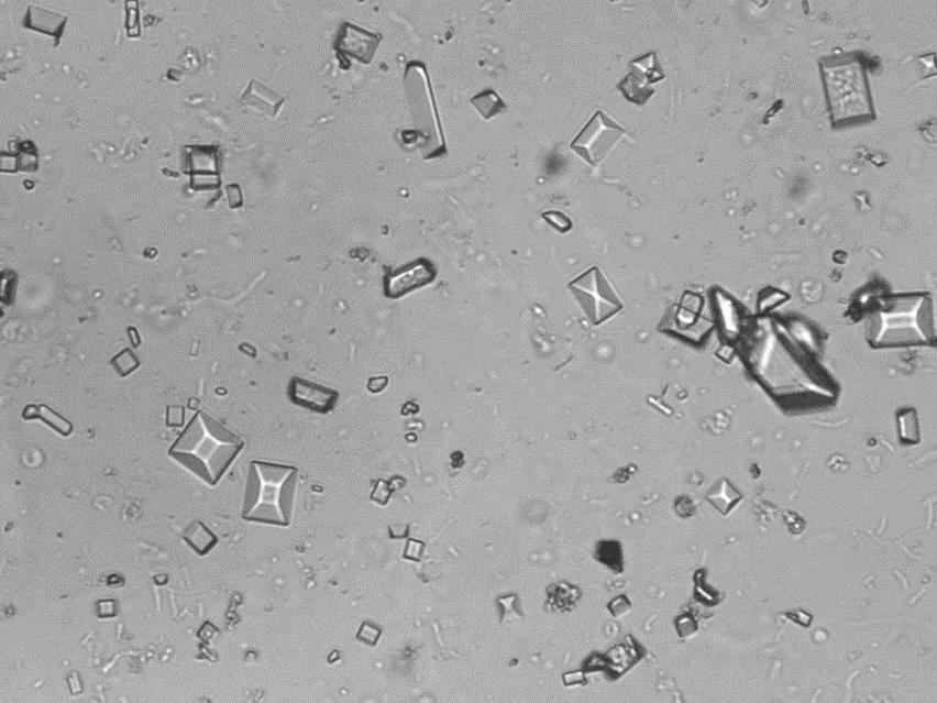 Cristales de glucosa en orina: ¿Qué son y qué significan? - Cuánto es lo normal de la glucosa en la orina cristales de glucosa en orina - Cuánto es lo normal de la glucosa en la orina