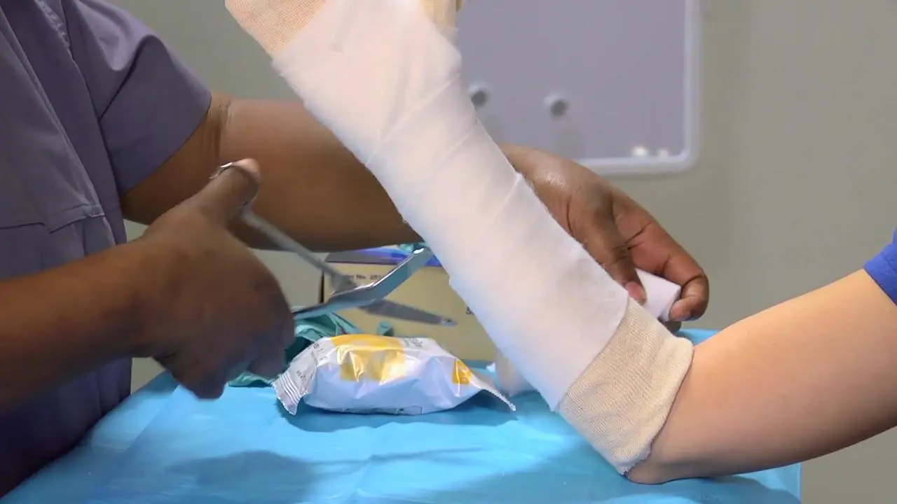 Cómo cortar un yeso de fibra de vidrio en casa - Qué es un yeso de fibra de vidrio como cortar un yeso de fibra de vidrio en casa - Qué es un yeso de fibra de vidrio