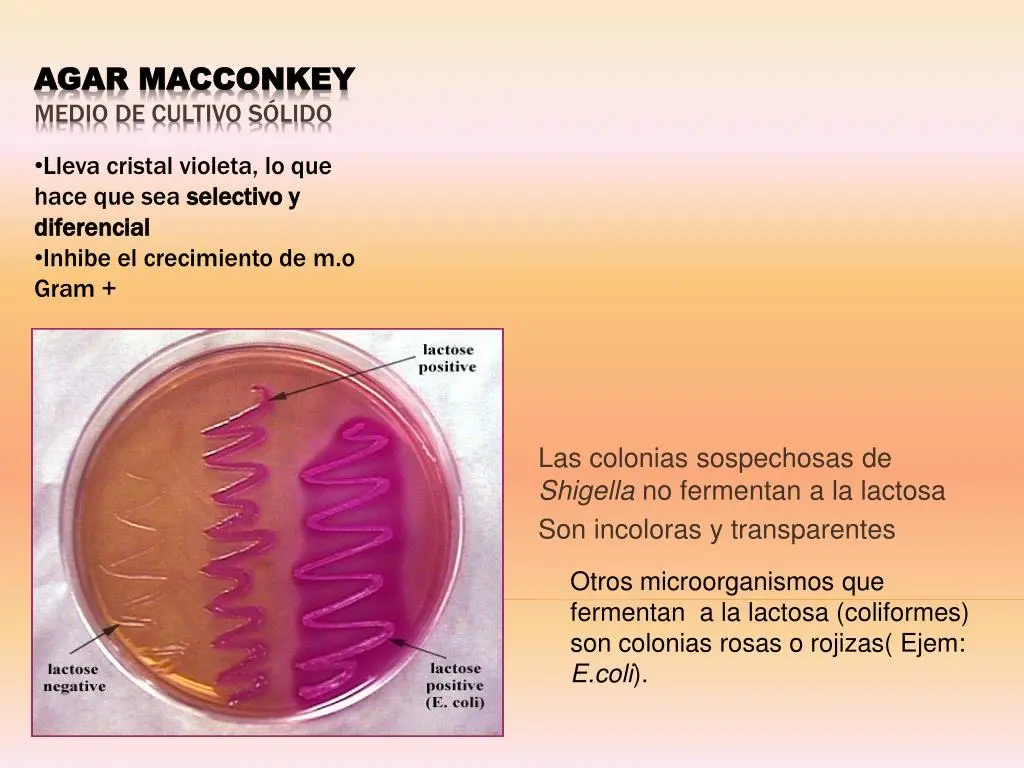 Cristal violeta en medios de cultivo: una herramienta clave para la detección de microorganismos - Que inhibe el cristal violeta cristal violeta en medios de cultivo - Que inhibe el cristal violeta