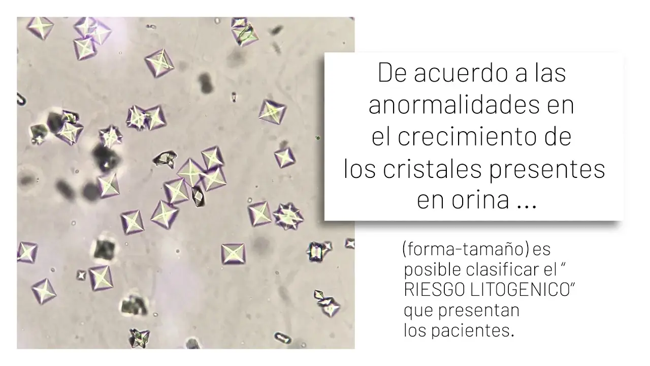 cristales en la orina en niños - Qué pasa si un niño tiene cristales en la orina