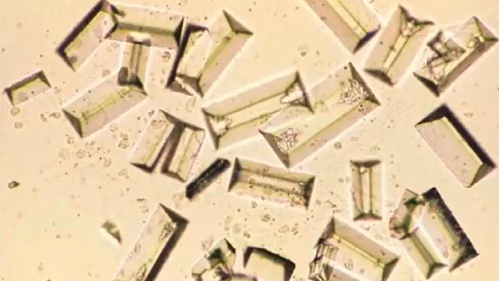 cristales de estruvita - Qué produce los cristales de estruvita en gatos