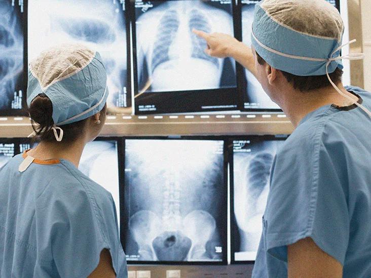 El vidrio esmerilado en los pulmones: Una señal de enfermedad pulmonar intersticial - Qué significa tener opacidad en los pulmones vidrio esmerilado pulmon - Qué significa tener opacidad en los pulmones